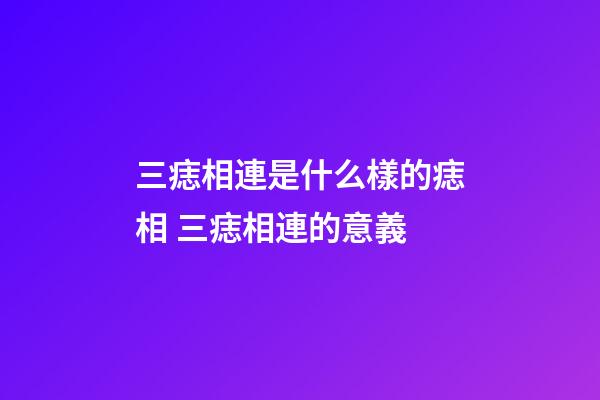 三痣相連是什么樣的痣相 三痣相連的意義